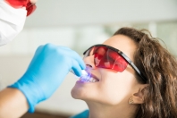 Jak dbać o zęby po wybieleniu